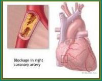cholesterol heart